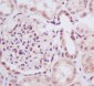 Anti-UBE2I/Ubc9 Rabbit Monoclonal Antibody