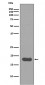 Anti-UBE2I/Ubc9 Rabbit Monoclonal Antibody