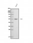 Anti-Fibrinogen beta chain/FGB Antibody Picoband™ (monoclonal, 6D12)