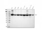 Anti-Transketolase/TKT Picoband™ Antibody (monoclonal, 3E5)