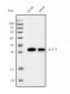 Anti- IL-5 Monoclonal Antibody