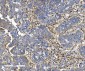 Anti-Integrin beta 5/ITGB5 Antibody Picoband™ (monoclonal, 9E2)