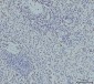 Anti-RPA32/RPA2 Antibody Picoband™ (monoclonal, 3B2E9)