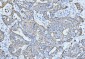 Anti-Cytokeratin 5 Antibody Picoband™ (monoclonal, 9H2F8)