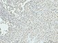 Anti-p95 NBS1 Antibody Picoband™ (monoclonal, 5D7A1)