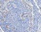Anti-FACL4/ACSL4 Antibody Picoband™ (monoclonal, 4I7)