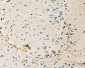 Anti-Neurofibromin/NF1 Antibody Picoband™ (monoclonal, 4C6F10)