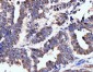 Anti-Neurofibromin/NF1 Antibody Picoband™ (monoclonal, 4C6F10)