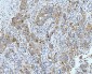 Anti-Neurofibromin/NF1 Antibody Picoband™ (monoclonal, 4F8B7)