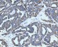 Anti-Neurofibromin/NF1 Antibody Picoband™ (monoclonal, 4F8B7)