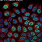 Anti-beta Tubulin Mouse Monoclonal Antibody