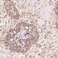 Anti-Akt(pan) 1/2/3 Rabbit Monoclonal Antibody