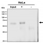 Anti-Akt(pan) 1/2/3 Rabbit Monoclonal Antibody