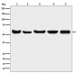 Anti-Akt(pan) 1/2/3 Rabbit Monoclonal Antibody