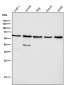 Anti-Akt(pan) 1/2/3 Rabbit Monoclonal Antibody