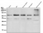 Anti-Akt(pan) 1/2/3 Rabbit Monoclonal Antibody