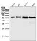 Anti-Akt(pan) 1/2/3 Rabbit Monoclonal Antibody