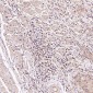 Anti-FOXP3 Rabbit Monoclonal Antibody