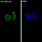 Anti-ARID1A Rabbit Monoclonal Antibody