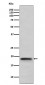 Anti-TNF beta Rabbit Monoclonal Antibody