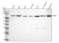 Anti-PI3 Kinase p85 alpha Rabbit Monoclonal Antibody