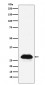 Anti-Carbonic anhydrase 2 Rabbit Monoclonal Antibody