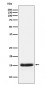 Anti-PLGF Rabbit Monoclonal Antibody