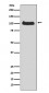 Anti-PKC mu Rabbit Monoclonal Antibody