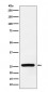 Anti-Superoxide Dismutase 3 Rabbit Monoclonal Antibody