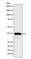 Anti-HSD11B1 Rabbit Monoclonal Antibody