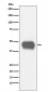 Anti-CD1a Rabbit Monoclonal Antibody