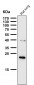 Anti-Ferritin Heavy Chain Rabbit Monoclonal Antibody