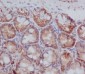 Anti-PKC beta 1 Rabbit Monoclonal Antibody