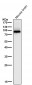 Anti-PKC beta 1 Rabbit Monoclonal Antibody