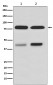 Anti-PKC beta 1 Rabbit Monoclonal Antibody