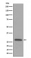 Anti-C1QB Rabbit Monoclonal Antibody