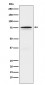 Anti-FOXO1 Rabbit Monoclonal Antibody