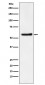 Anti-DKC1 Rabbit Monoclonal Antibody