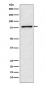 Anti-Fructose 6 Phosphate Kinase Rabbit Monoclonal Antibody