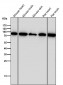 Anti-Fructose 6 Phosphate Kinase Rabbit Monoclonal Antibody