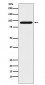 Anti-ALDH1L1 Rabbit Monoclonal Antibody