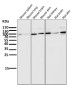 Anti-ALDH1L1 Rabbit Monoclonal Antibody