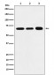 Anti-P70 S6 Kinase alpha Rabbit Monoclonal Antibody