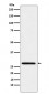 Anti-Peroxiredoxin 4 Rabbit Monoclonal Antibody