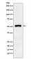 Anti-Retinoic Acid Receptor gamma Rabbit Monoclonal Antibody