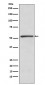 Anti-TBLR1 Rabbit Monoclonal Antibody