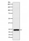 Anti-Rab25 Rabbit Monoclonal Antibody