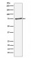 Anti-PIAS1 Rabbit Monoclonal Antibody