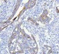 Anti-IGFBP2 Rabbit Monoclonal Antibody