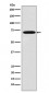 Anti-Plastin L Rabbit Monoclonal Antibody